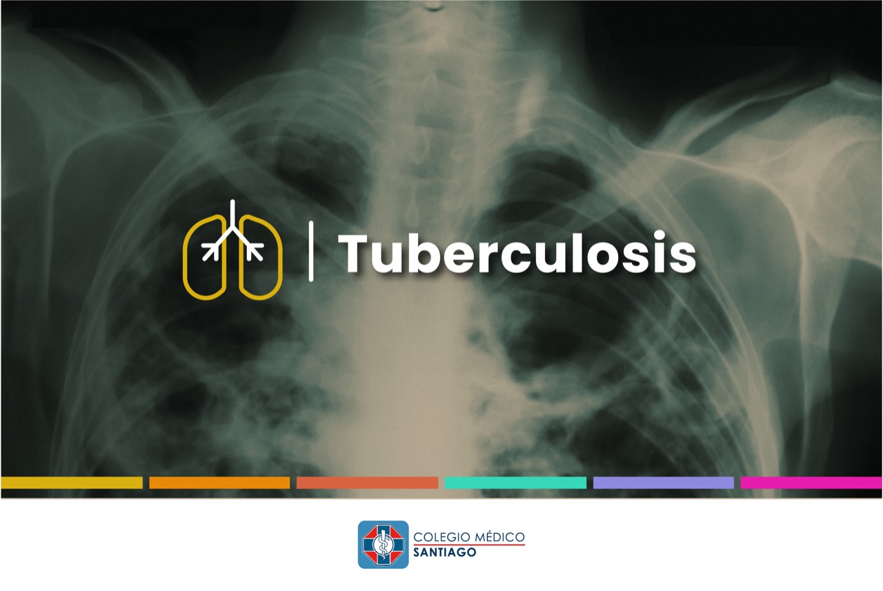 Tuberculosis en Chile. Una enfermedad silenciosa que no es cosa del